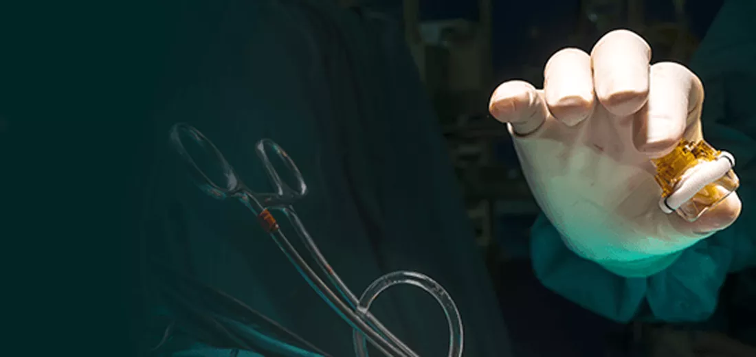 transcatheter-aortic-valve-replacement-2