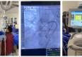 Crayoablation ENG Minimal invasive heart surgery Aster Medcity Kochi