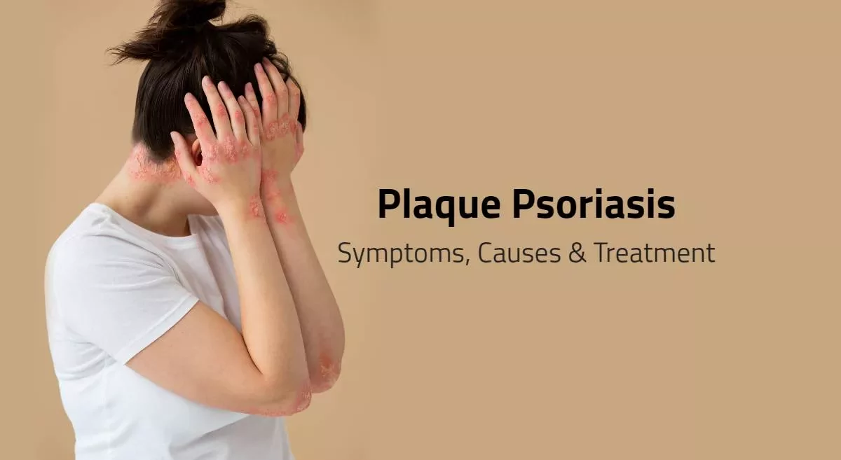 Plaque Psoriasis - Causes, Symptoms & Treatment
