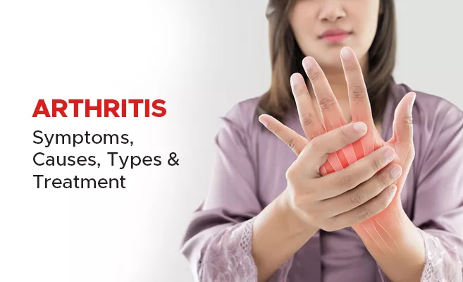 Arthritis - Symptoms, Causes, Types & Treatment