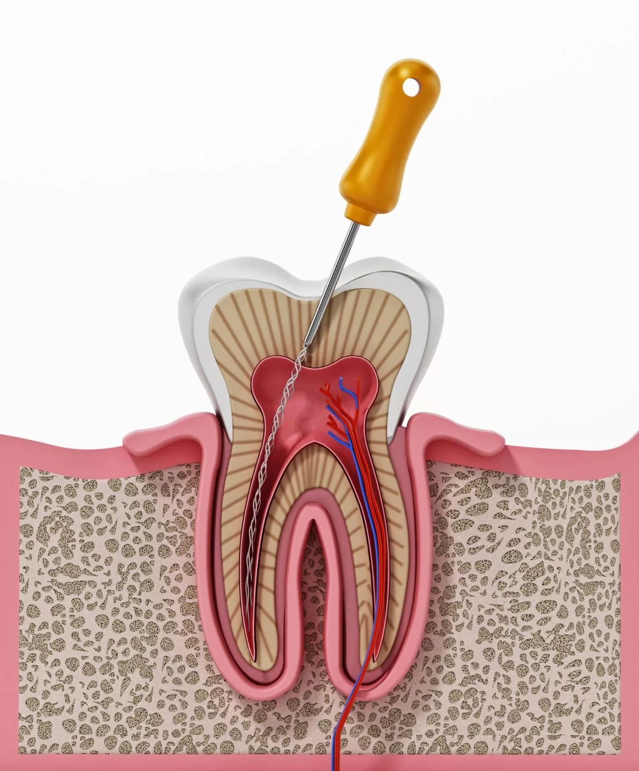 Root Canal Treatment.jpg