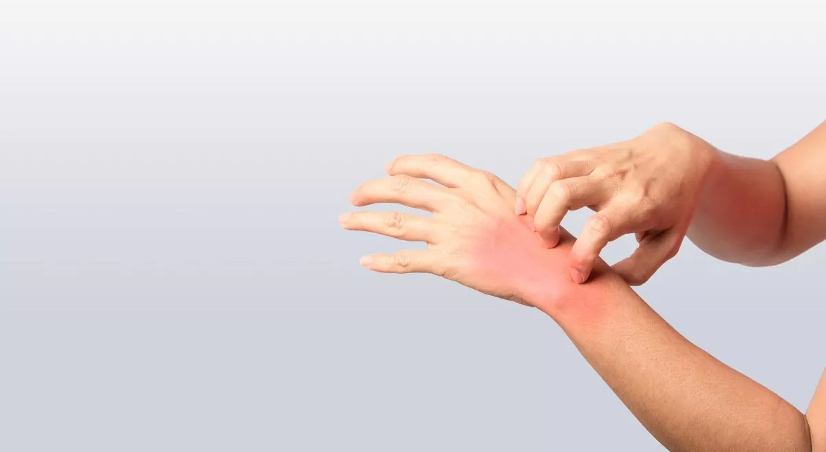 Why does your skin suffer as the weather changes 