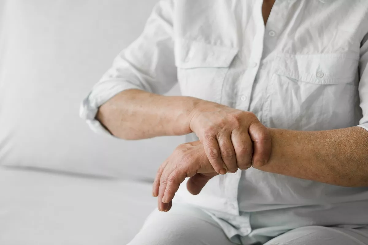 rheumatoid arthritis