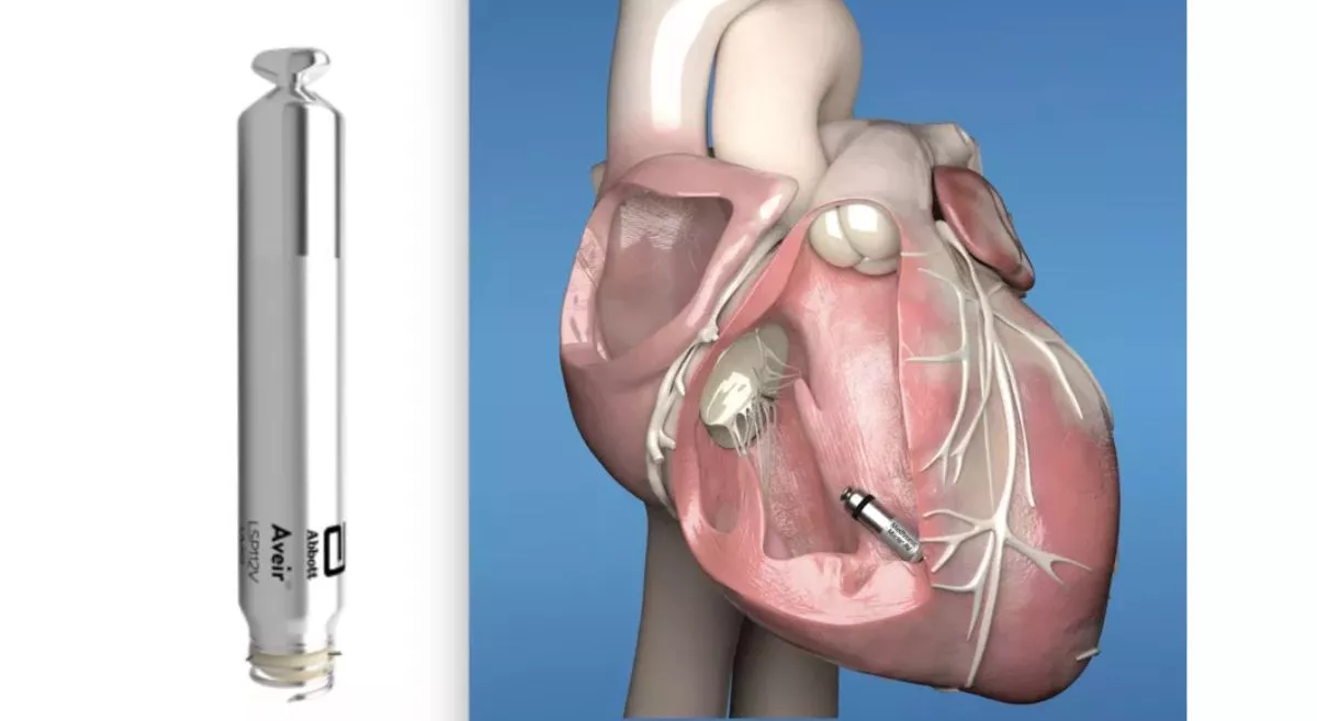 How Leadless Pacemakers Are a Technological Marvel in Cardiac Sciences