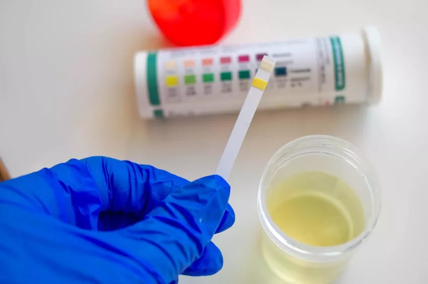 Ketones in Urine