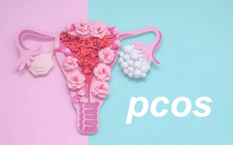 PCOS