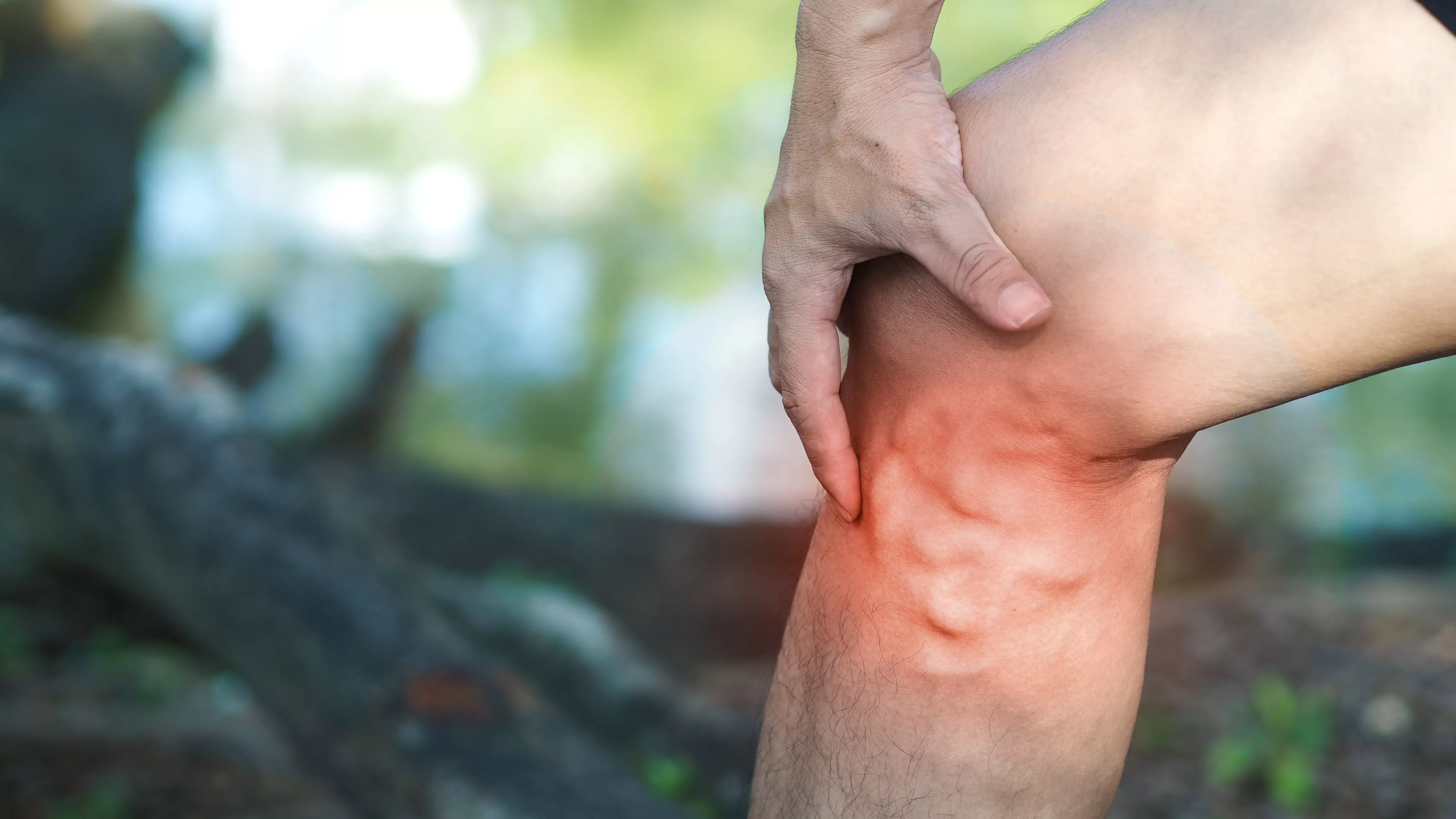 Know About Varicose Veins-Signs, Symptoms and Treatment, Aster CMI Bangalore. Varicose Veins Treatment in Bangalore