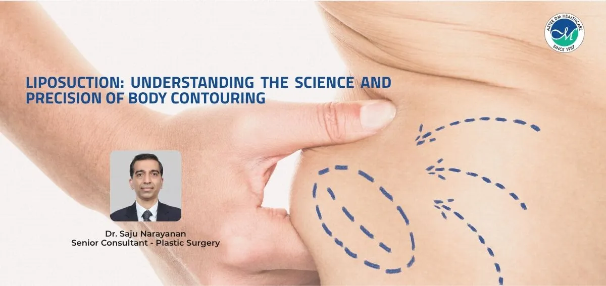Liposuction 
