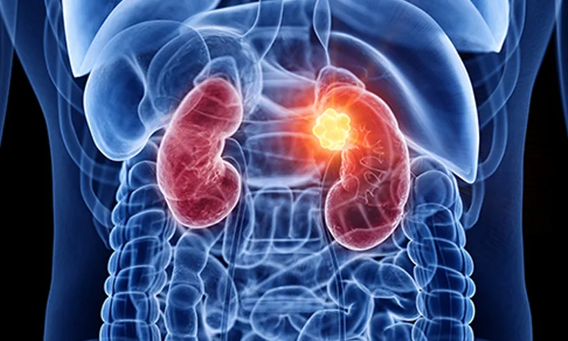 kidney disease 