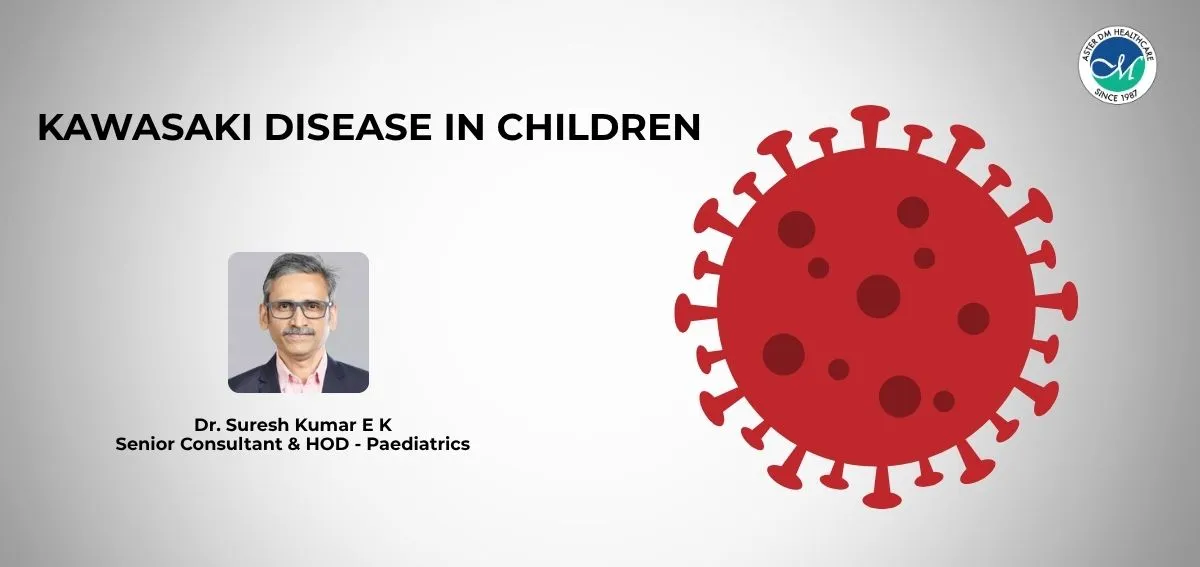 Kawasaki disease in children