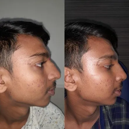 crooked umesh