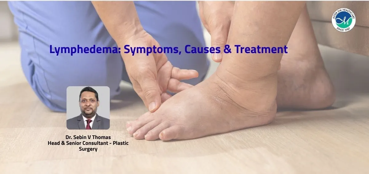 LYMPHEDEMA CLINIC