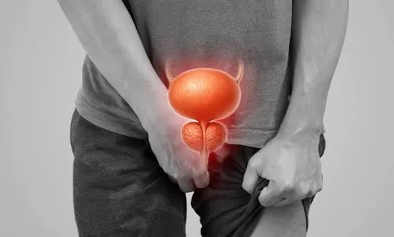 Prostate Cancer