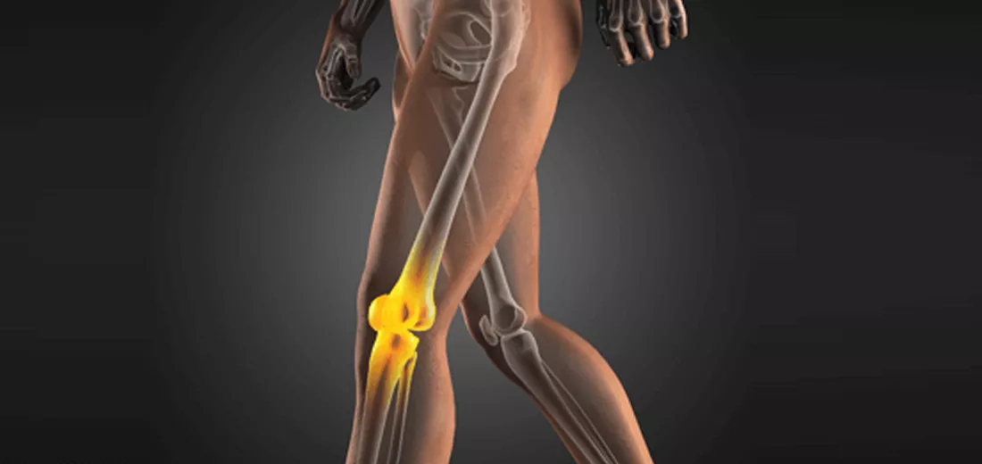 arthritis-knee-treatment-bangalore-2