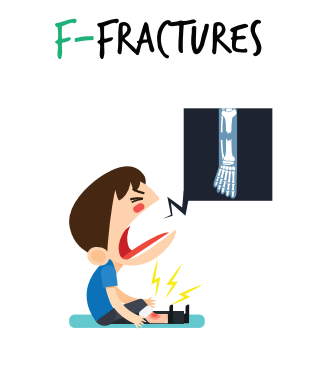 Fracture