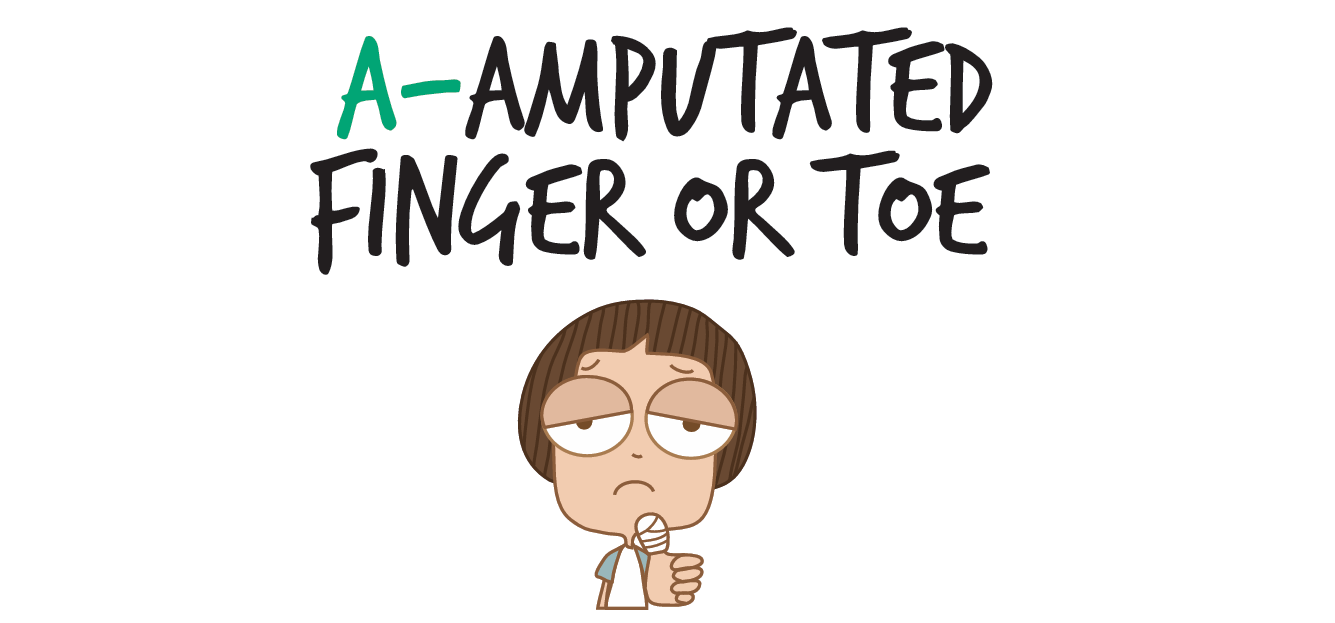 amputated